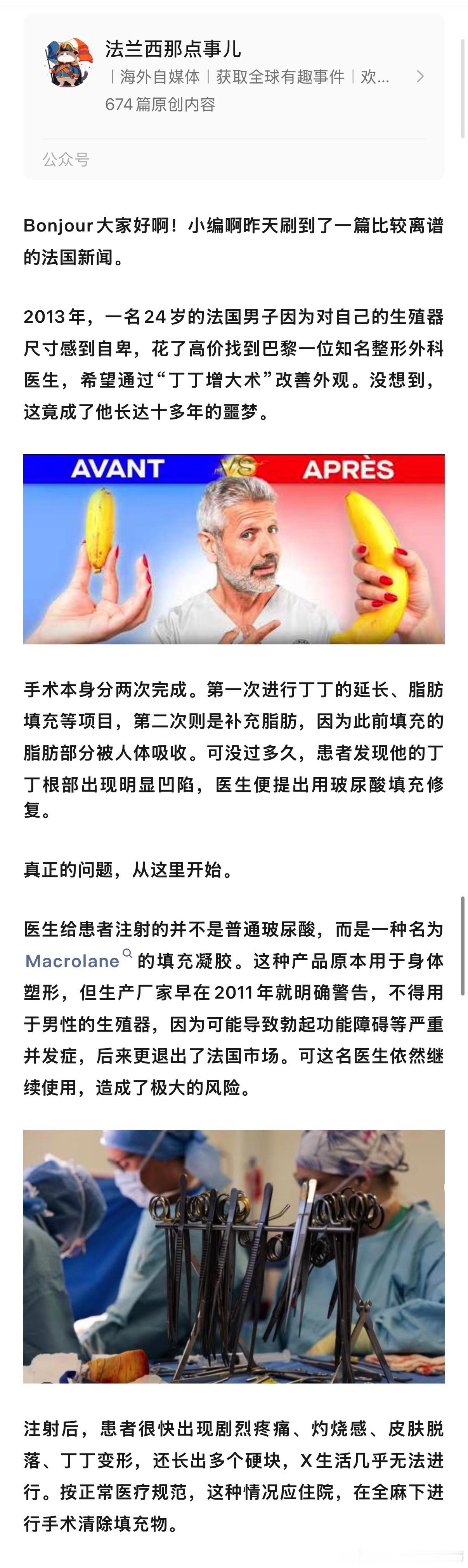 看了个贼离谱的事情！法国一个男的觉得自己JJ小，于是找了巴黎一个非常有名的整形外