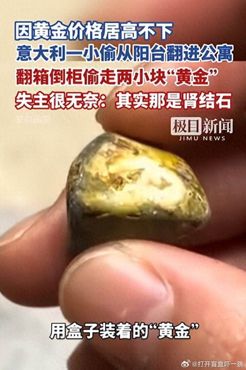 这新闻真难绷！说是意大利媒体《威尼托信使报》前副主编把自己的肾结石收藏在家，当地