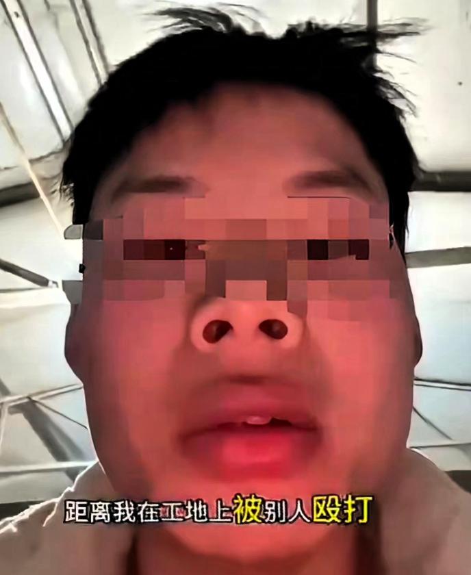 一小伙子在工地挨打六天后：“打我的司机听着，我不是怕你，因为我过几个月就要做爸爸