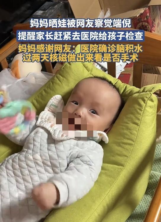 浙江一位宝妈，在网上晒自家几个月大的娃，不料娃娃的视频一发布，便引起了网友们的关