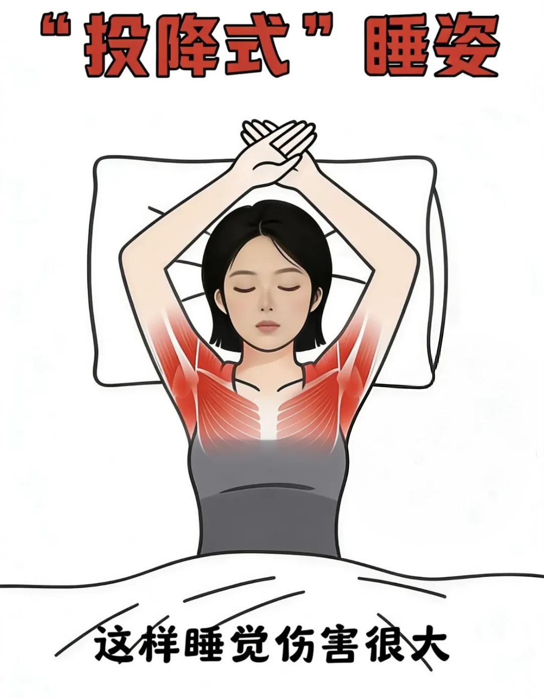 举手式睡姿是身体在求救举手式睡姿是身体在求救。很多人睡觉时喜欢把手举过头顶，像个“投降”的姿势，觉得