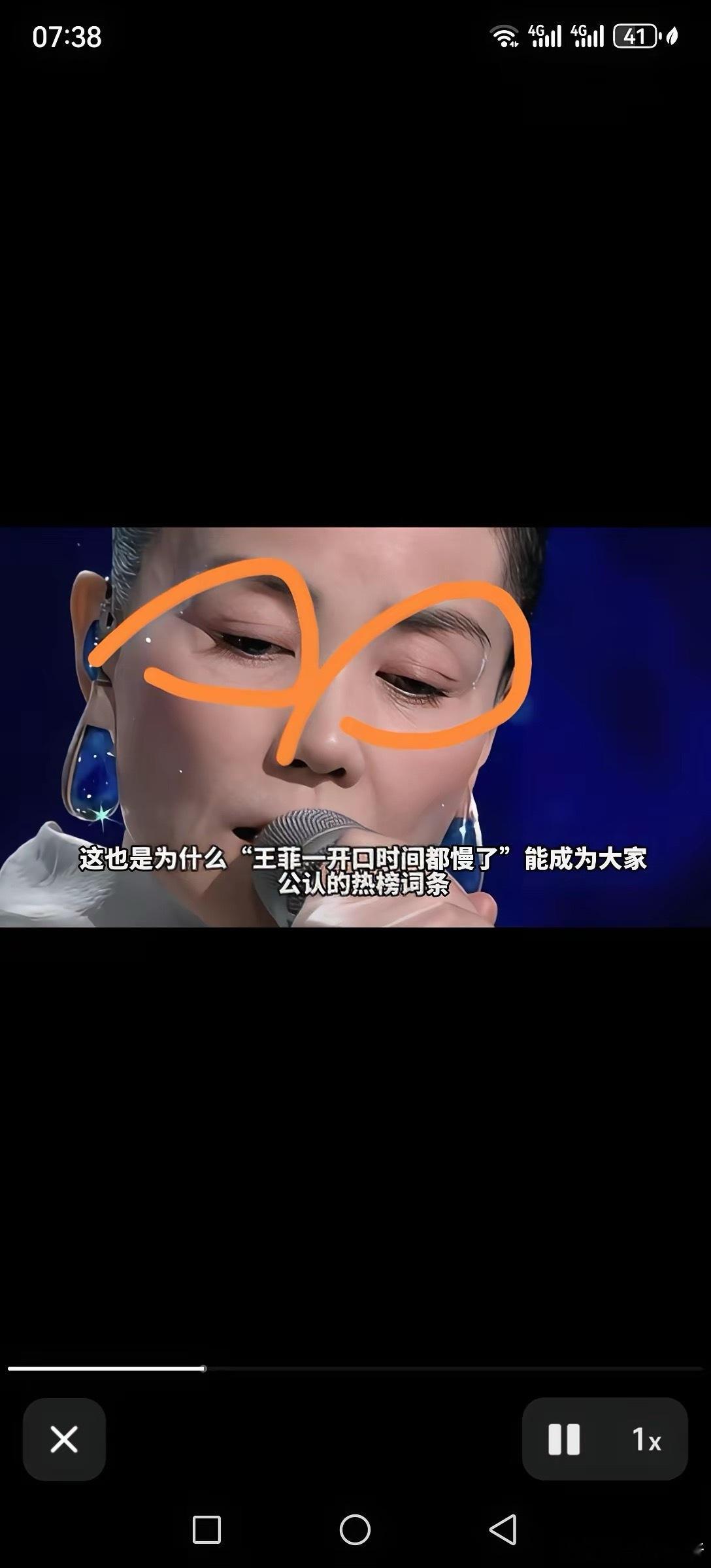 春晚王菲双眼皮太逗了，都翘起来了。