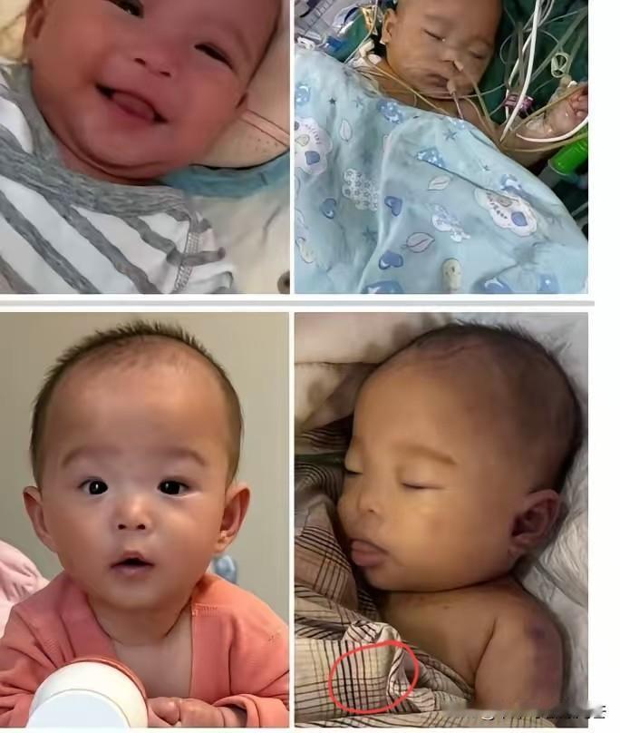 谁能想到，五个月大的宝宝，竟然没能熬过一场手术？术前十几个小时没喝奶，这么