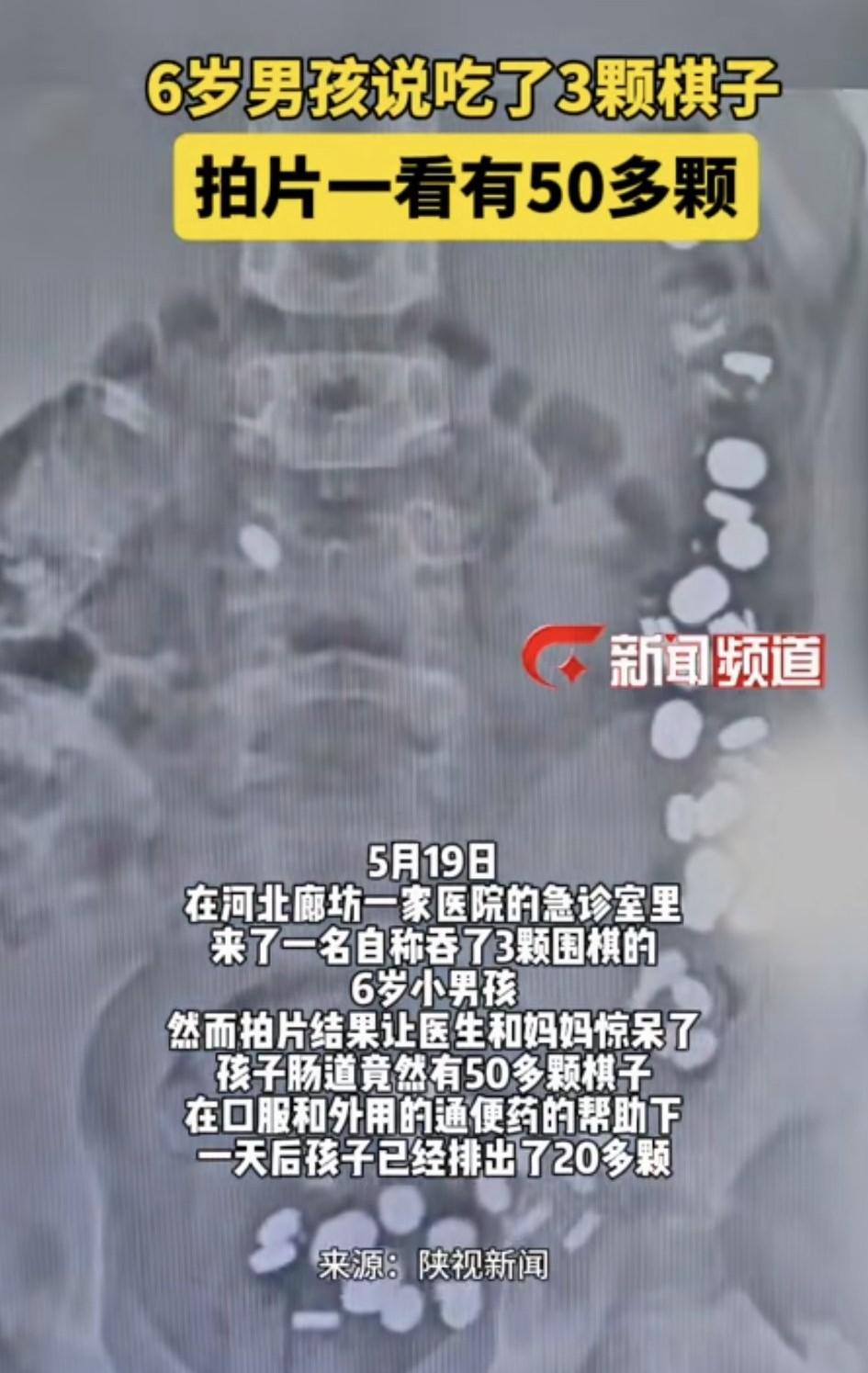 万万没有想到，河北廊坊，一名6岁男孩玩着玩着，突然告诉妈妈自己吞了3颗棋子下肚，