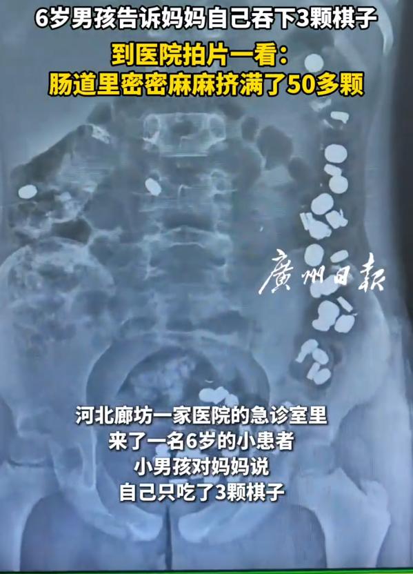 “这也太离谱了！”河北廊坊，一6岁男孩告诉妈妈自己只吞下了3颗棋子。妈妈吓得火速