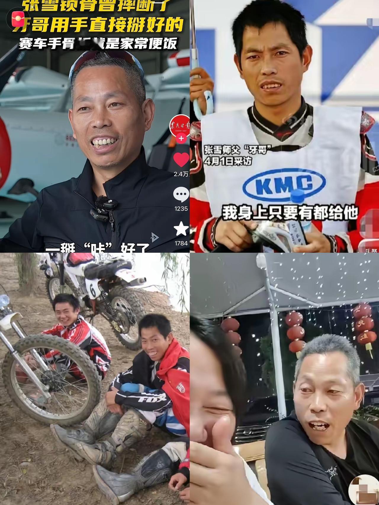 这是什么狠人宗门！锁骨断了直接徒手掰回，看得人头皮发麻。张雪训练摔断锁骨，医院