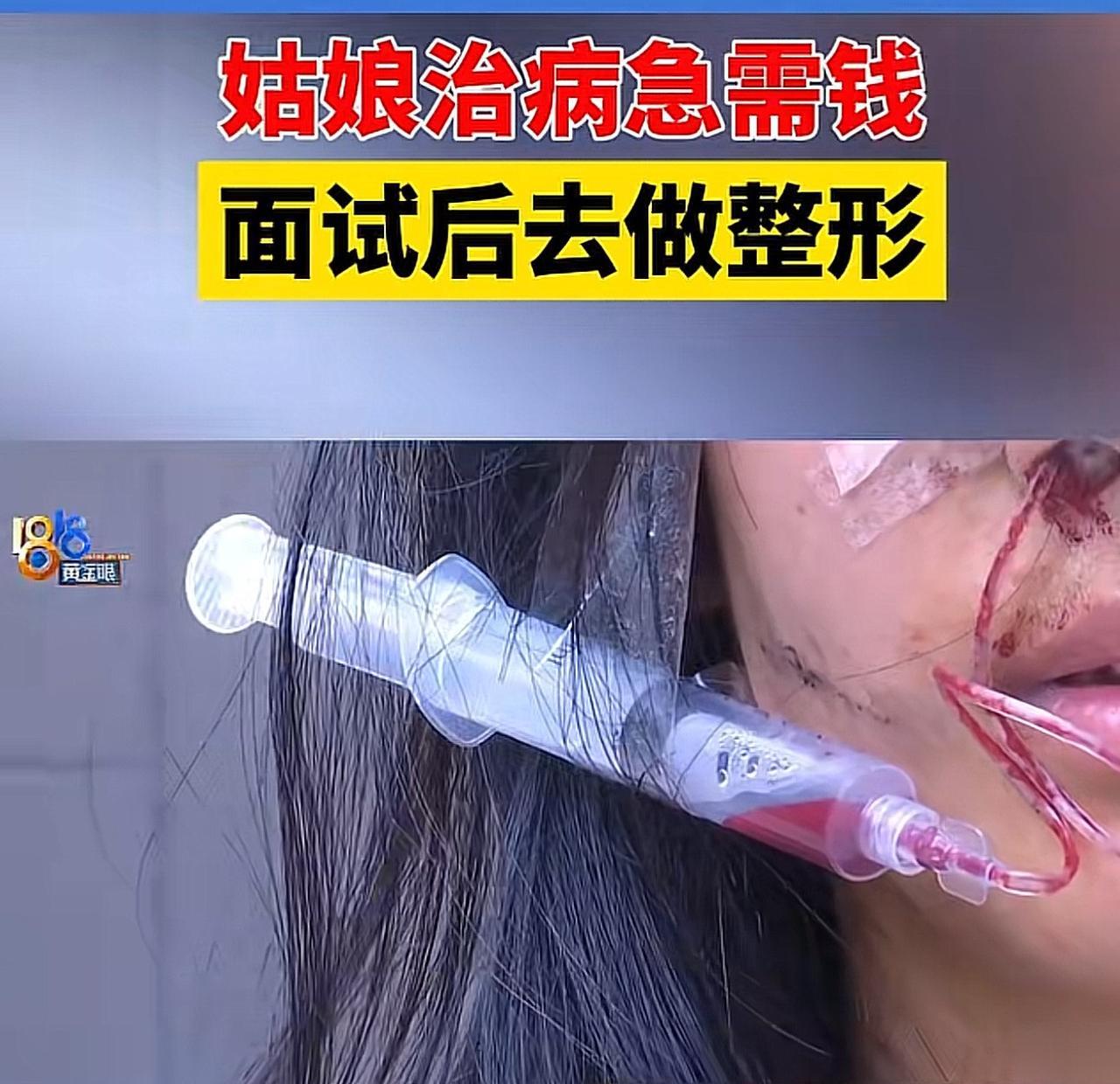 谁能想到，蔡女士满心欢喜的从山东老家来到杭州找高薪工作，最后却满脸是伤，还背上了