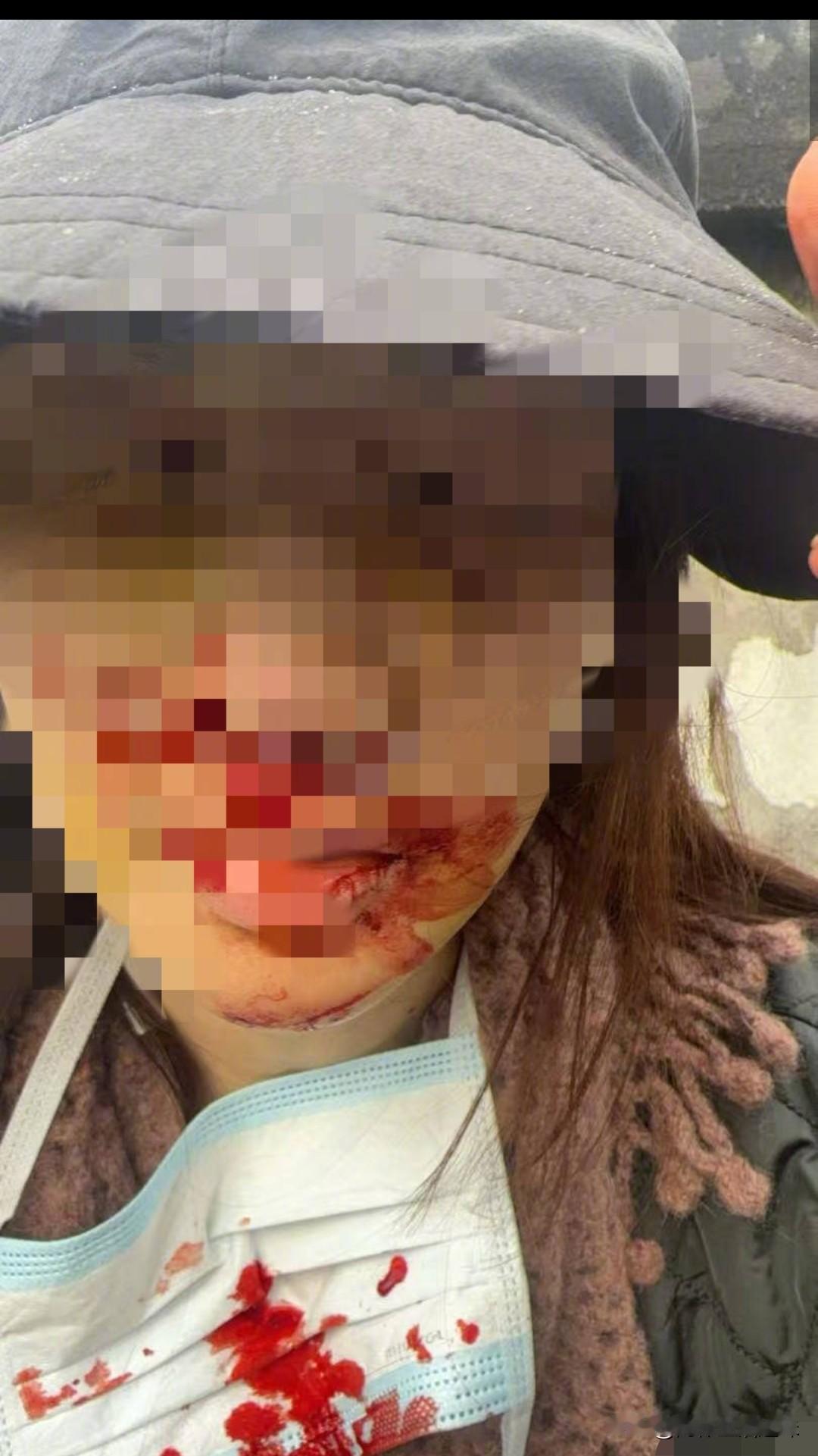 完了这波“穷追猛打”金晨怕是招架不住了交警已发布通告已实证金某驾驶车出了交