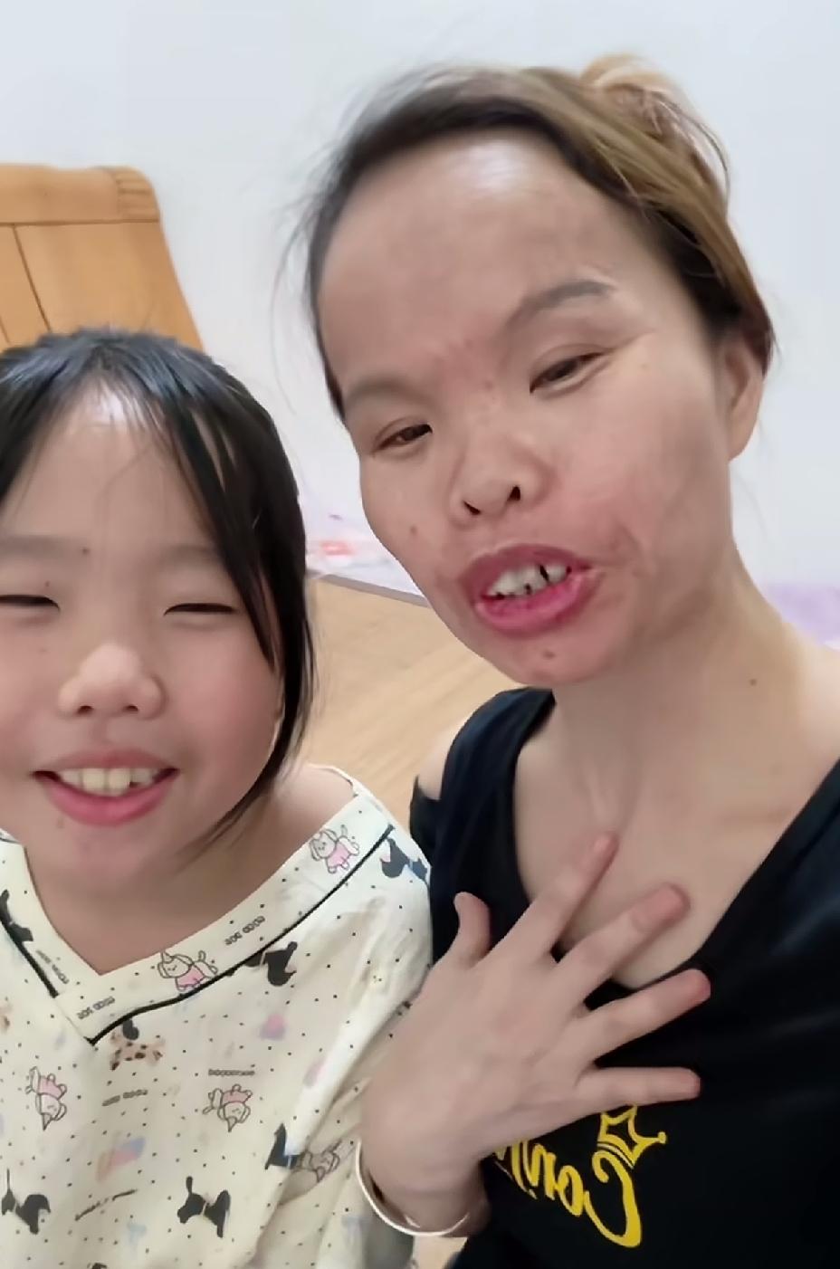 这小女孩幸好没有完全遗传到她妈妈的外貌，虽然像妈妈，但是比妈妈好看了太多太多。