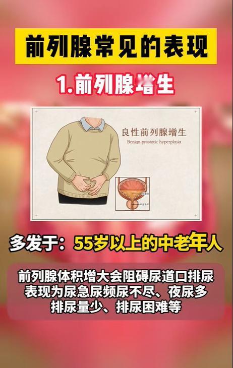 前列腺常见的表现！