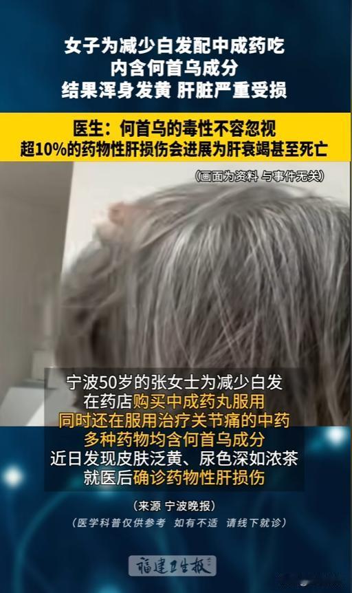 药不能乱吃！”8月21日报道，浙江宁波，一女子为了减少头上白发，自己去药店买了含