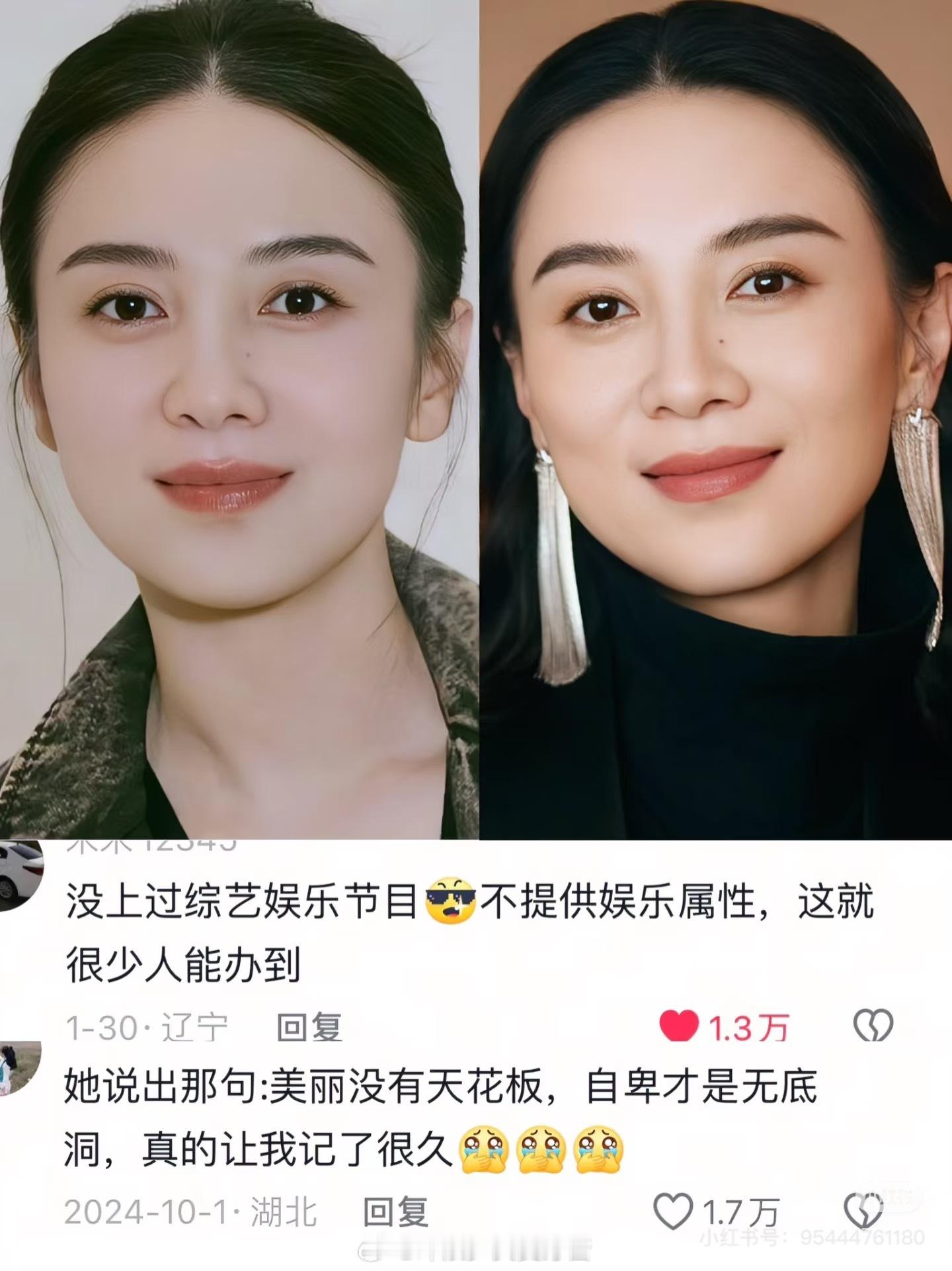 宋佳，绝对是个狠人。​​​