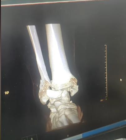 闲弓不要拉，闲马不要骑，闲人不要浪，闲球不要踢。昨天晚上和朋友喝酒，聊起他十几