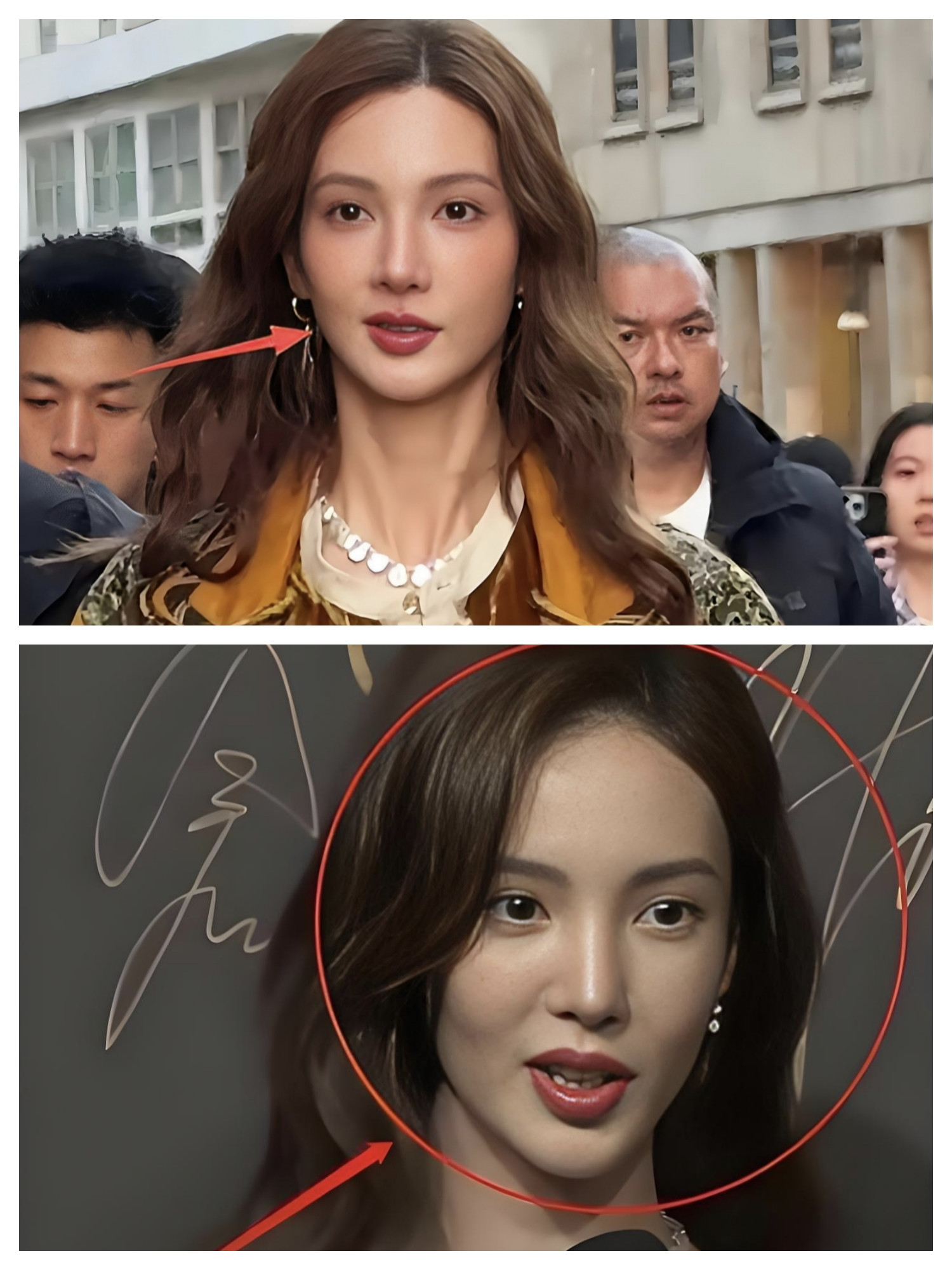 好奇查了下金晨歪嘴的原因，不查不知道，一查太意外，才发现跳舞真的影响她嘴歪的