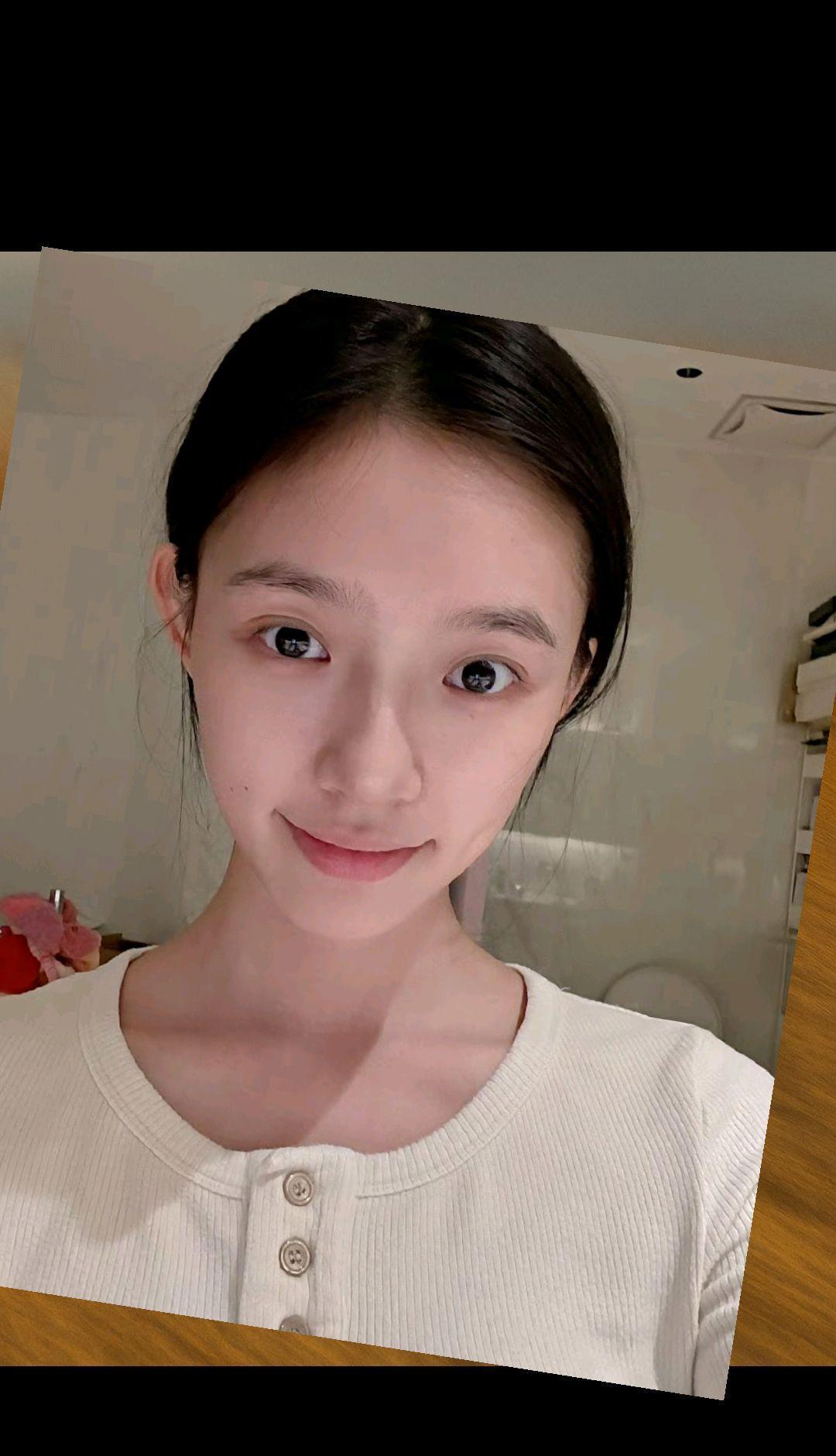 真是可惜了，林允已经走上了医美的不归路。总是发一些医美后的照片。到底想做什么
