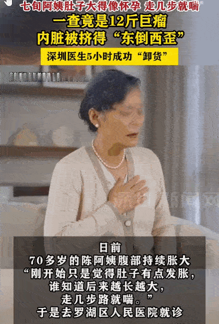 万万没想到！广东，一70岁阿姨起初发现腹部隆起，只当是老年发福。但短短数月，肚子
