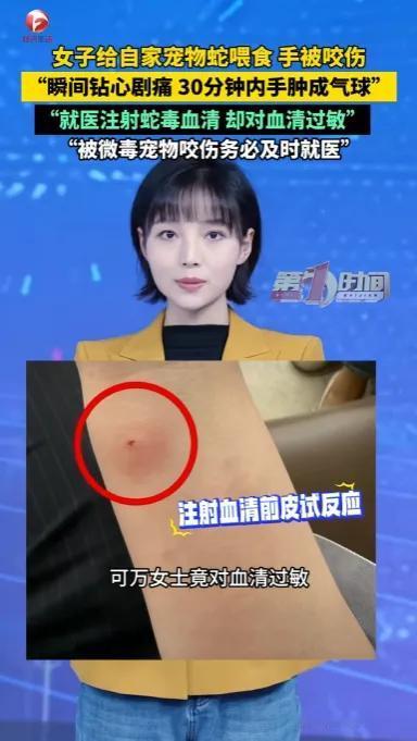 🌛太离谱了！江苏一女生在家饲养了一条宠物猪鼻蛇，却因疏忽连续三四个星期没有