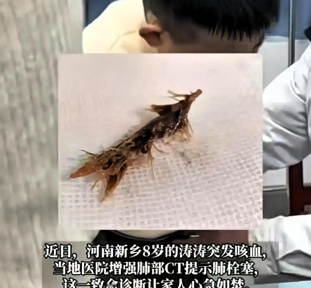 网上都在骂河南那个医院，说人家水平不行，差点耽误了孩子其实他们已经尽了力。8