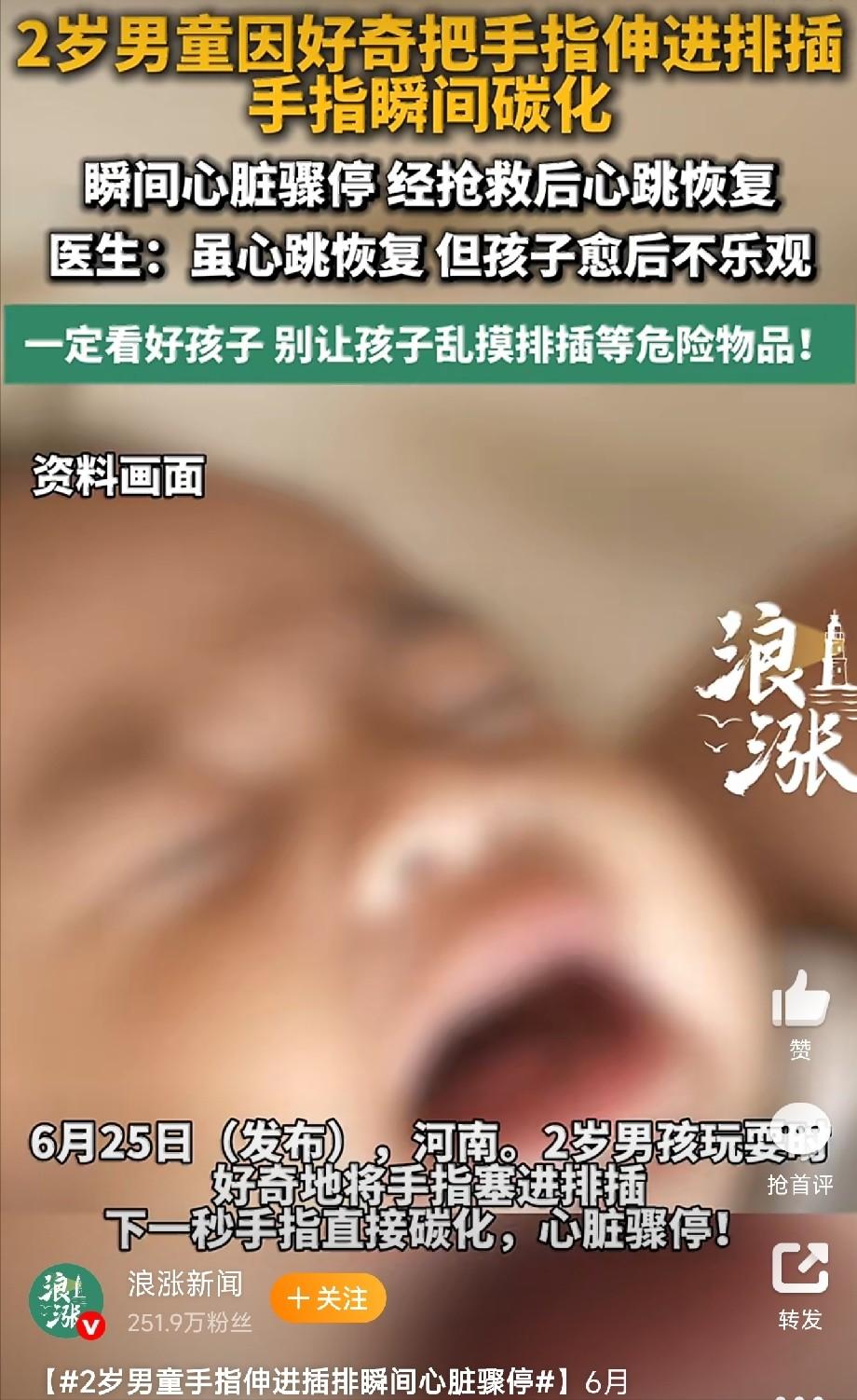太痛心了！河南一个2岁的小男孩，趁大人没注意，把手指头塞进了排插的插孔里。就那