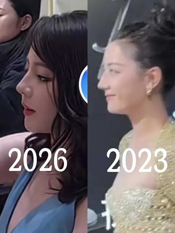 她跟章子怡前段时间肿的好相似。。。是出了什么难吸收的新医美技术吗。。。。