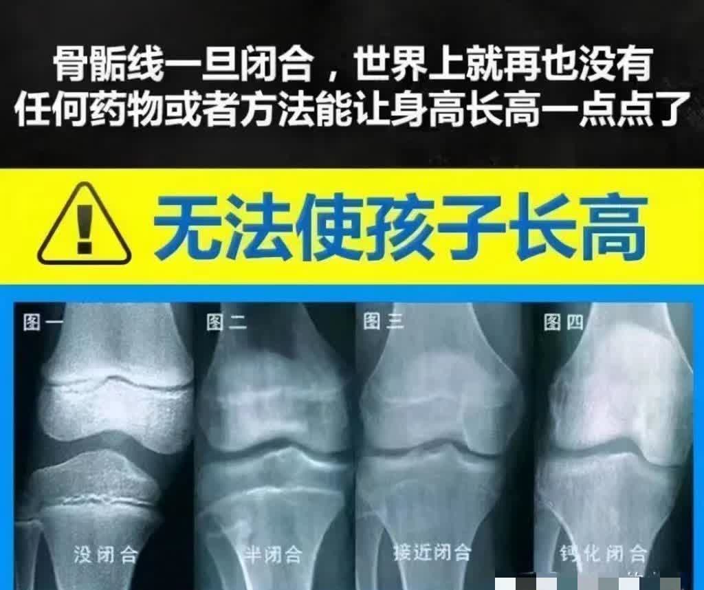 男孩有以下特征暗示骨骺线将闭合，可能要停止长高了！第一、身高长期不变