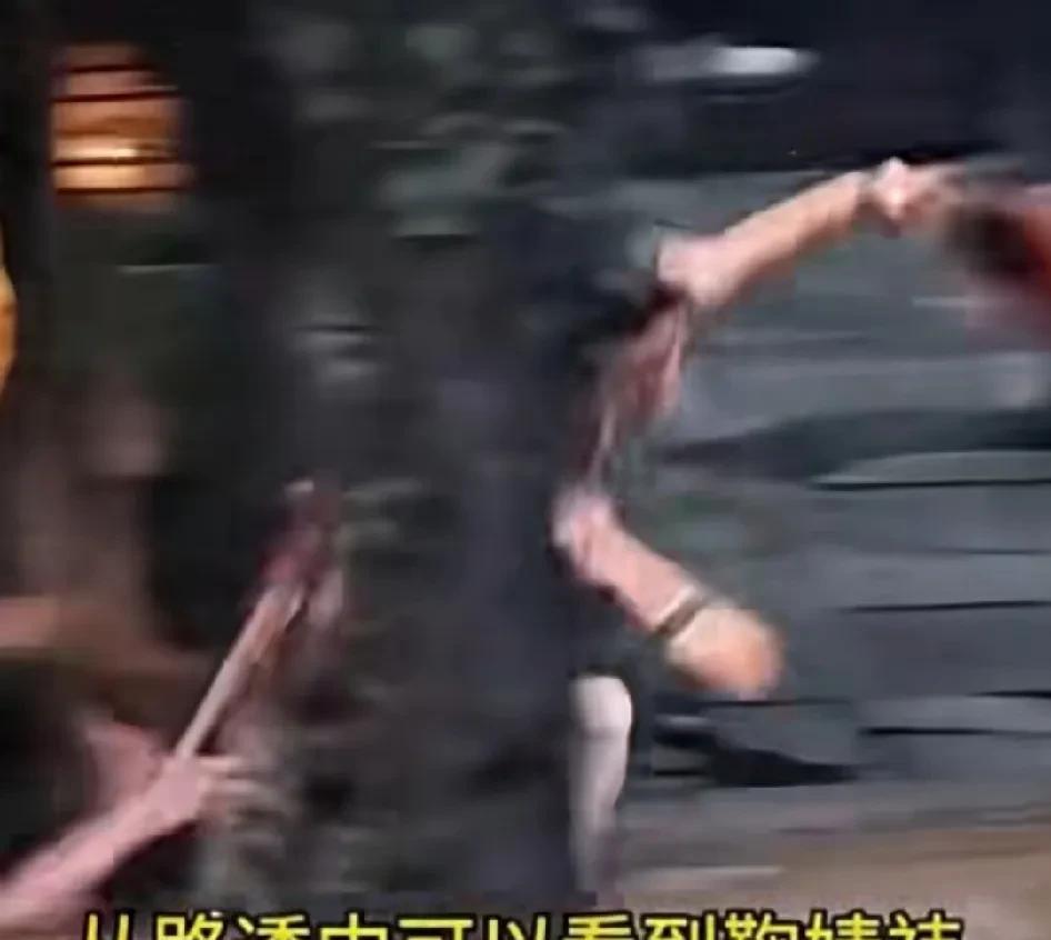 鞠婧祎在片场拍戏时，一个没走稳踉跄的摔倒了，下巴磕到了石桌上直接撞伤了，她惨叫出