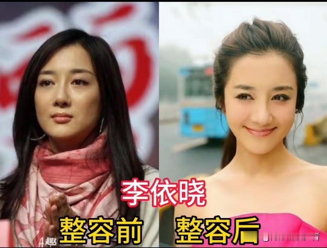 15位当红女明星的旧照和现在对比，变化真不小。像李依晓、杨紫、杨幂这些女星，早