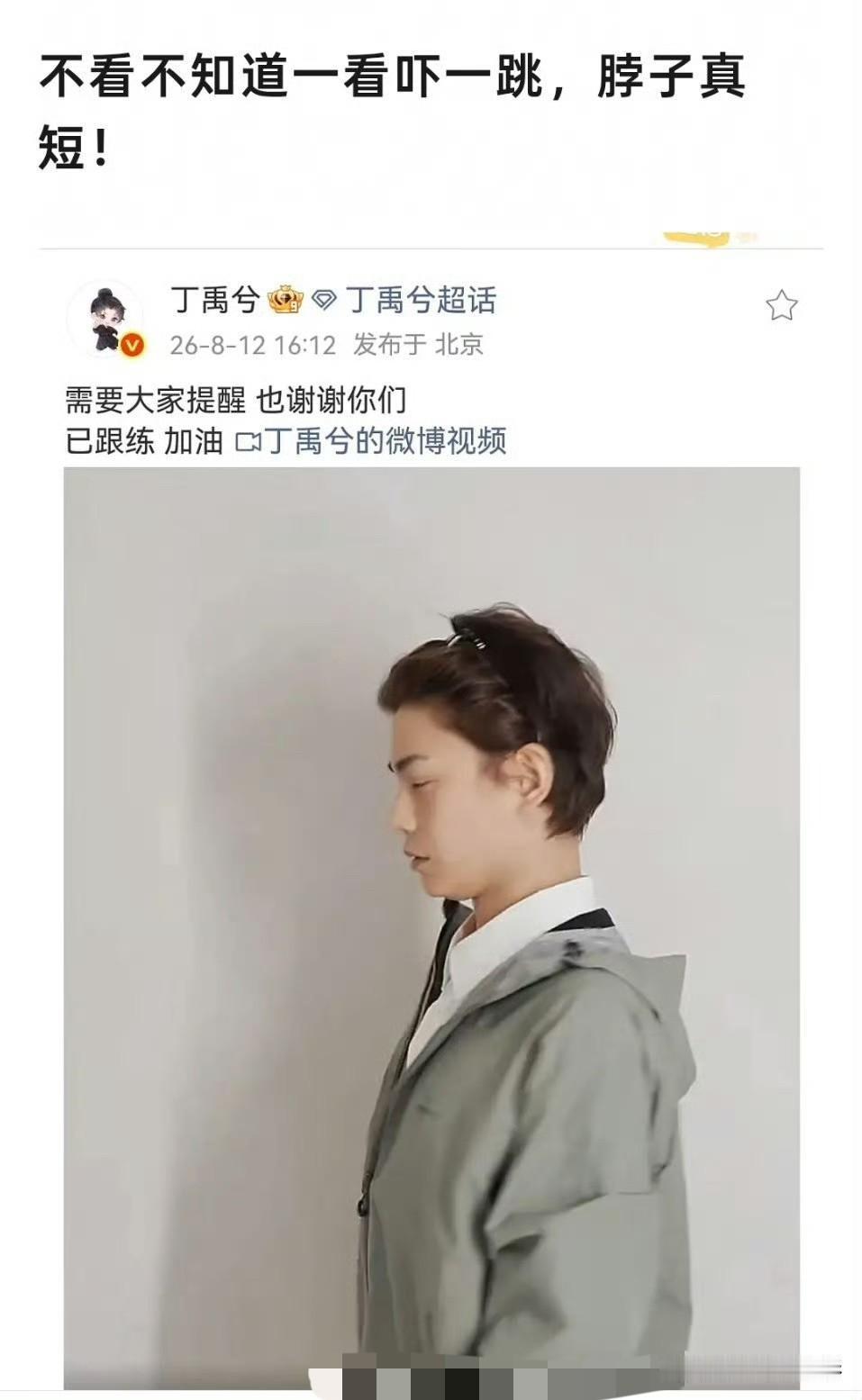 丁禹兮在《花开锦绣》剧中总梗着脖子的表演状态，引来不少争议，观众直言他执着于模板