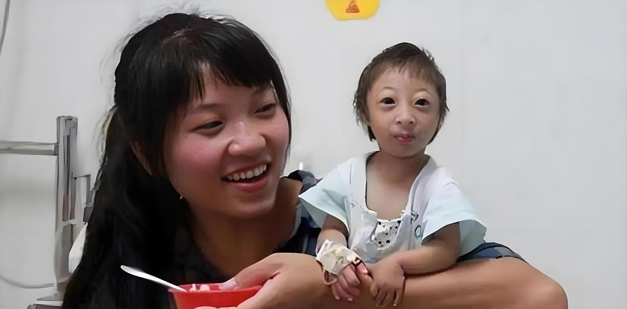 2009年，湖南一对夫妇生下“小猴子”，杂技团出价5万想要将她买走，如今16年过