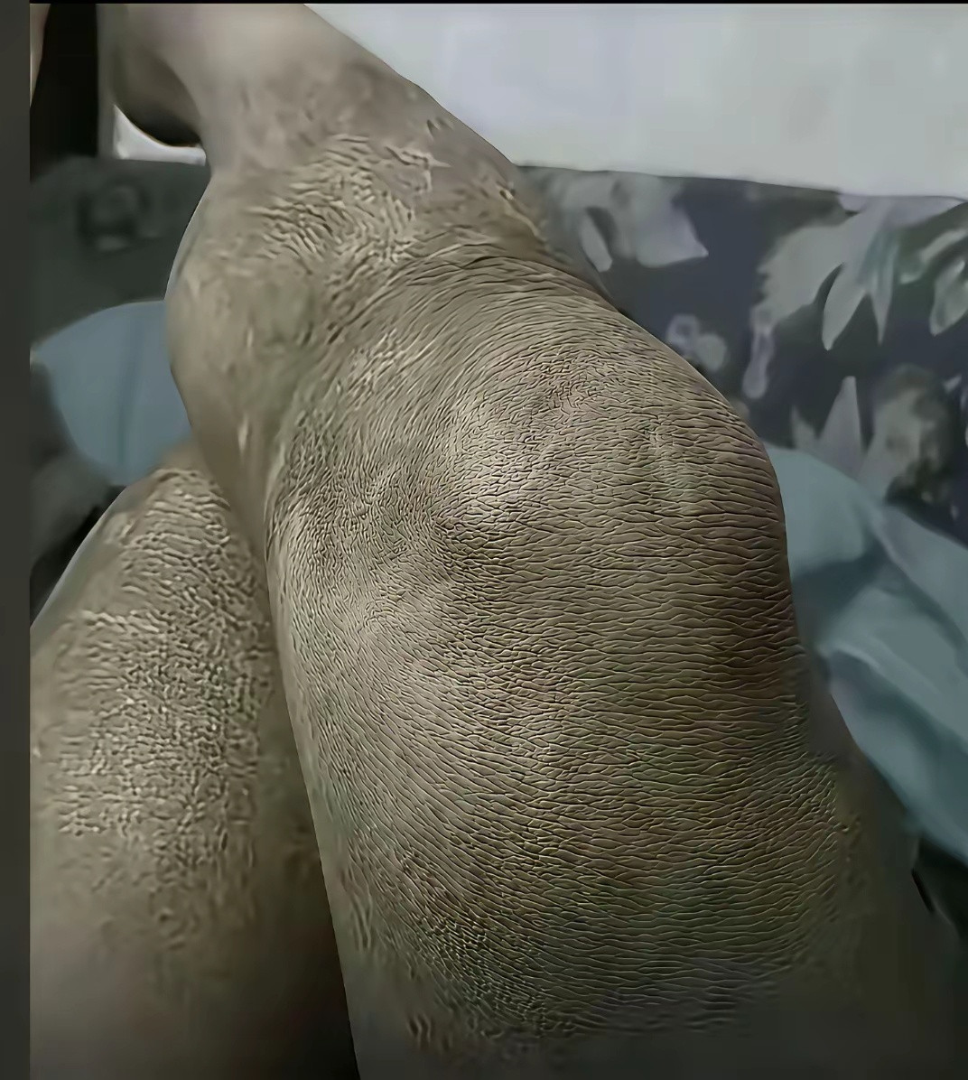 网友：问问大家，这个皮肤问题挂什么科？