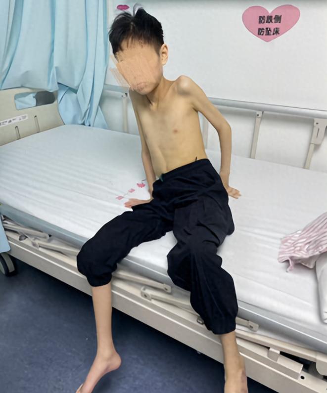 悲剧还是发生了！江西一名17岁少年，反复呕吐、无法进食，身高1米5的他，体重一度