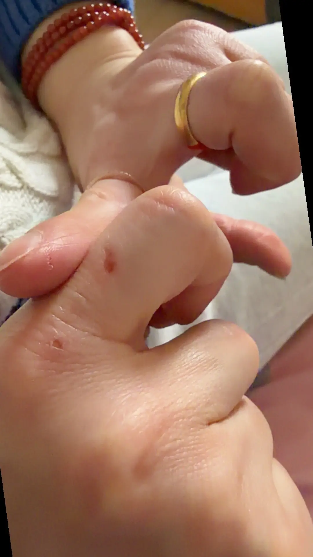 我这是……每天一刀疤