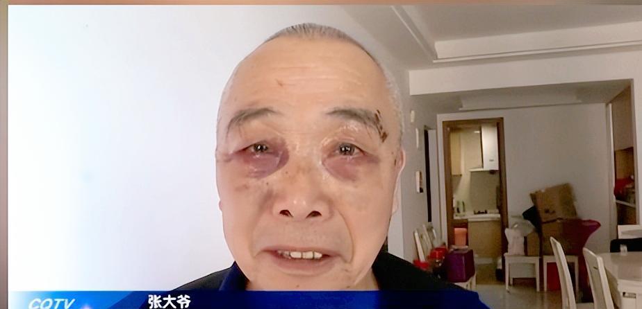 忽悠死人不偿命！重庆，70多岁大爷出门散步，不料碰到美容院的人对他说“不割眼袋会