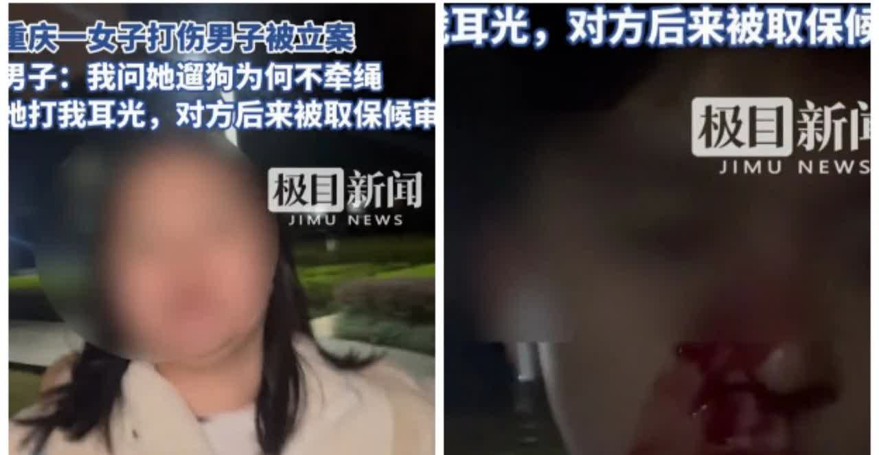 完了碰上个有背景的，他只能吃哑巴亏了！[捂脸哭]起因是重庆一男子牵着绳在小区遛