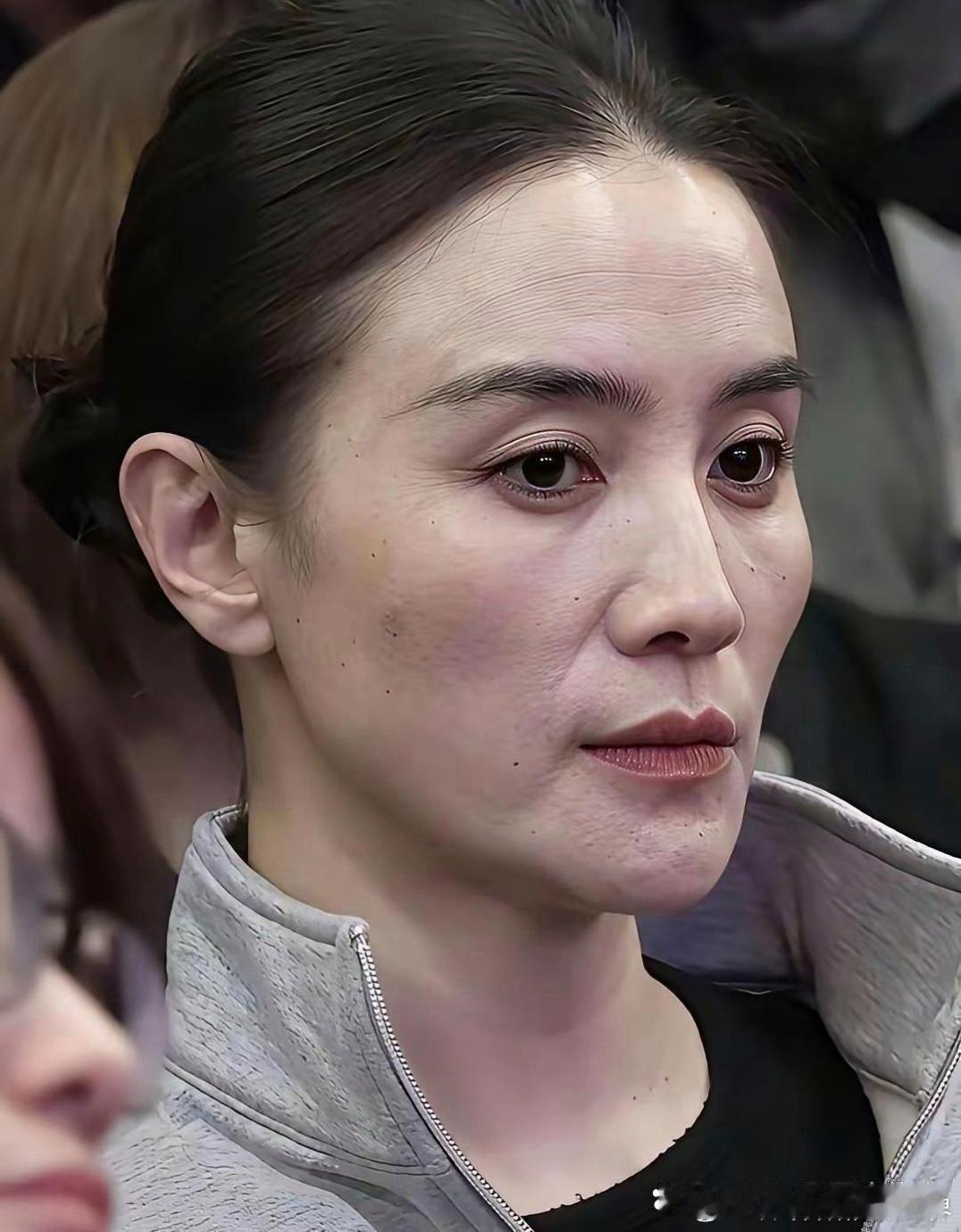 宋佳这状态，真是真实到没滤镜​