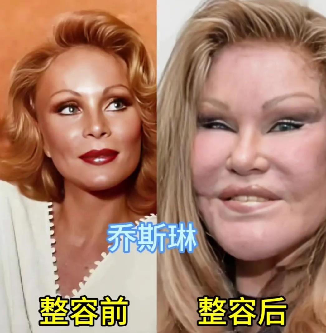 年轻时个个风华绝代，一味执着留住容颜，反而弄丢了原本的自己。自然老去，才是