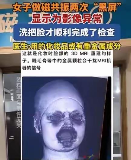 解释不清了！福建一29岁女生头晕，去医院做头颅磁共振。不料，连续2次扫描，都