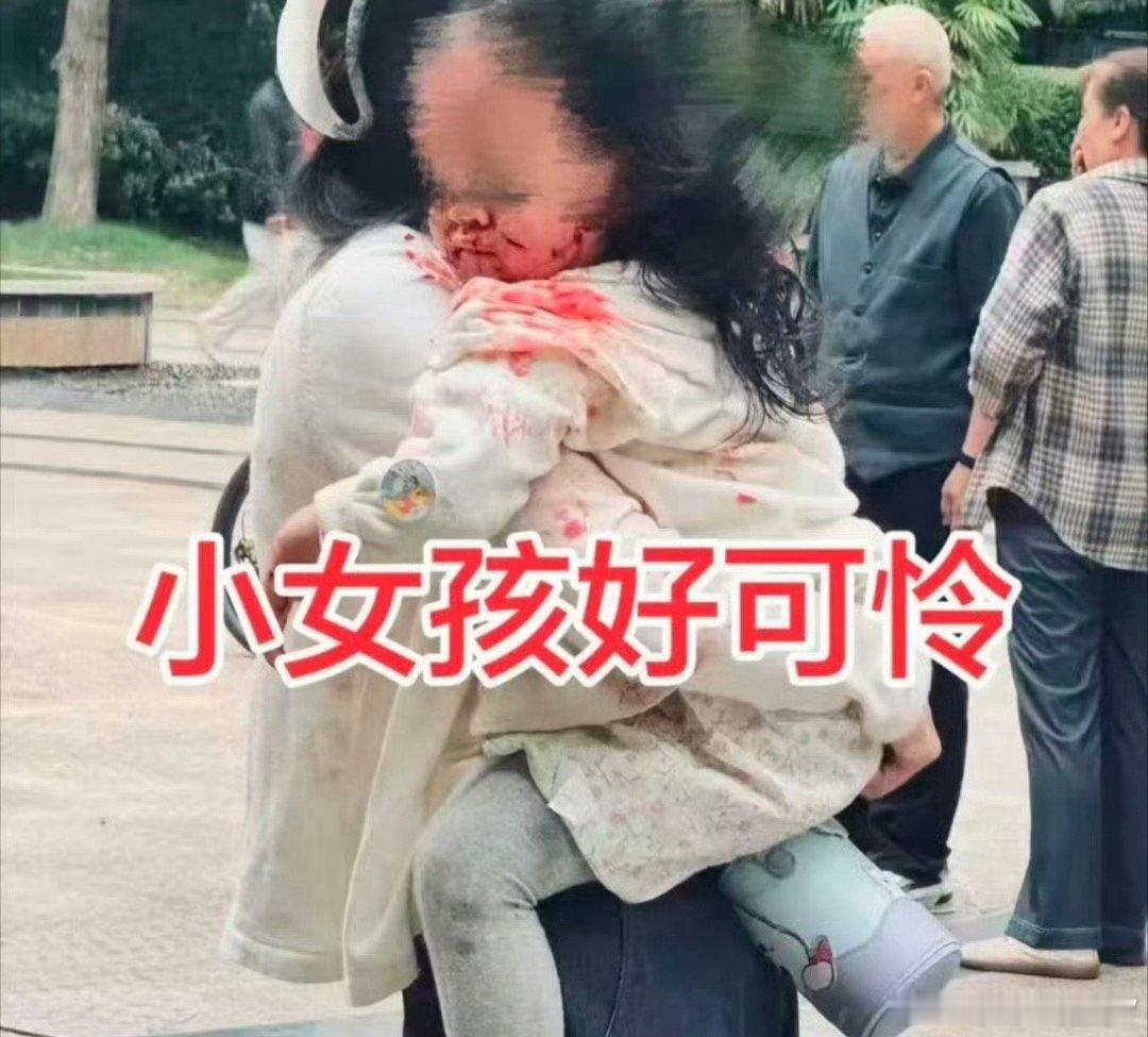 #眉山一小区宠物狗失控咬伤多人#看着应该是牛头梗，禁养犬只，咬伤多人。。。狗主人会怎么处理呢？​