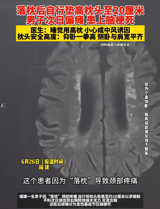 “悲剧还是发生了！”6月26日报道，福建，一男子因“落枕”导致颈部疼痛，他自行将