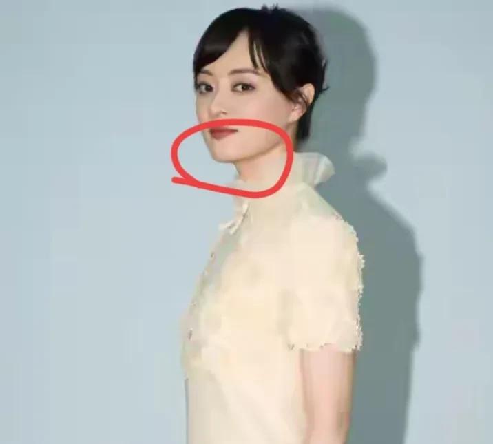 孙俪真的是个谜让人完全看不懂了先前网友都呼吁她把那个下巴痣给取了，她无动于衷