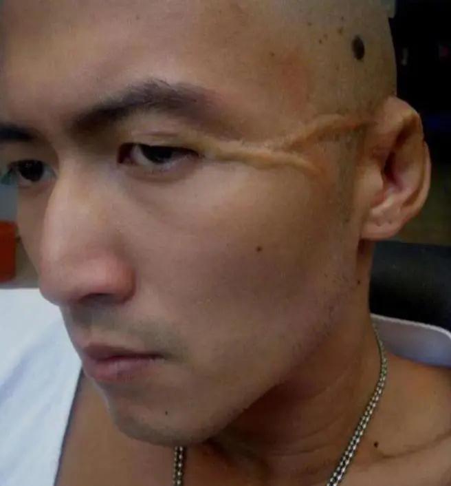 2012年，谢霆锋被查出患有皮肤癌，拿起电话第一件事就是通知前妻张柏芝：如果我不