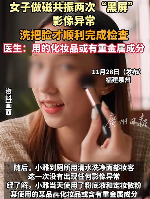 福建有个29岁女生头晕去医院做头部磁共振，结果机器扫到一半突然黑屏。医生问她有没