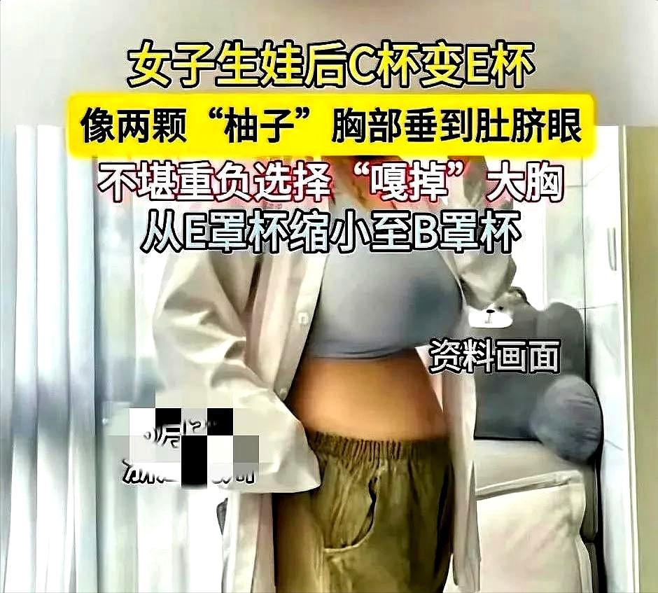杭州32岁的赵女士的胸实在太大了！夜里她老公看见她解开内衣，在揉搓肩膀上两道很深