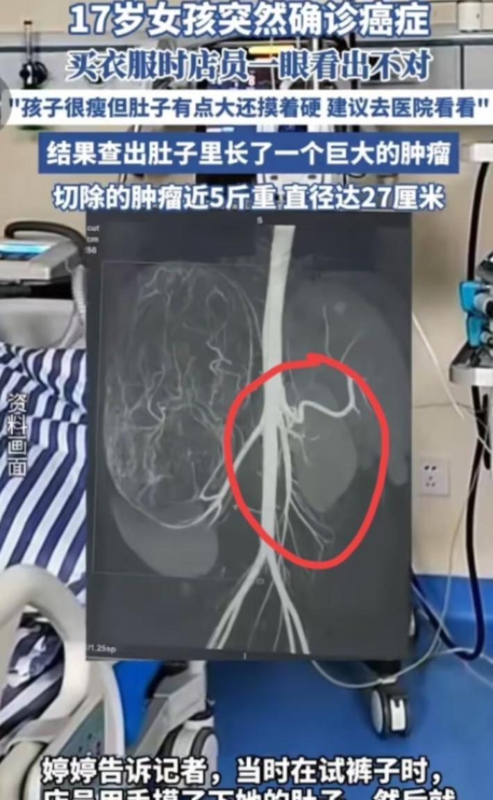 2025年6月，广东17岁女孩和妈妈一起逛街买衣服，在试裤子的时候，老板娘发觉女