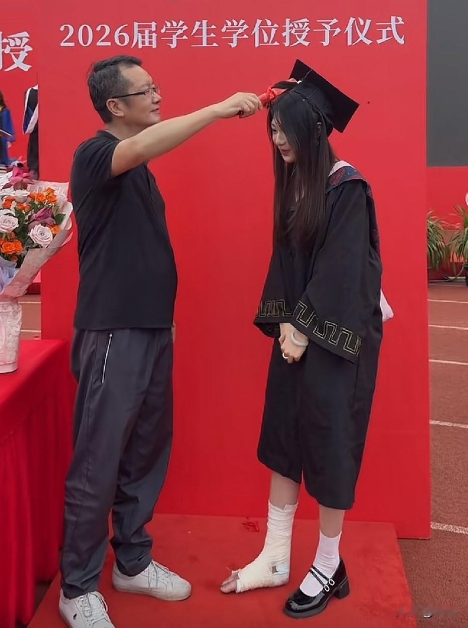 就我看见石膏了吗[？？？]