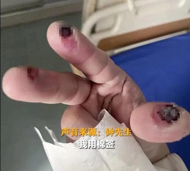 警惕清洁剂中隐藏的“化骨水”! 你家可能也有→