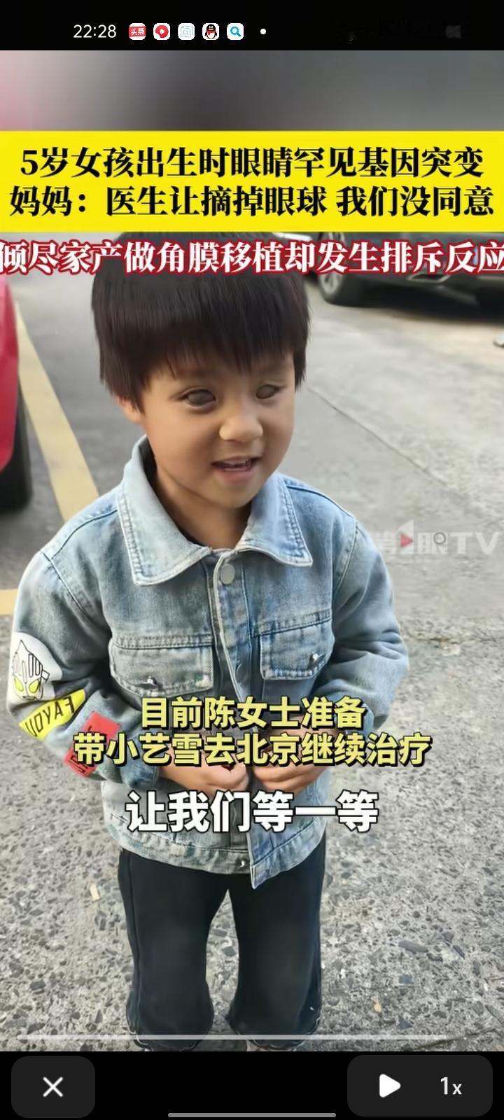 10月29日,上海。孩子妈妈陈女士称,2020年出生的女孩眼睛没有发育好,出现罕