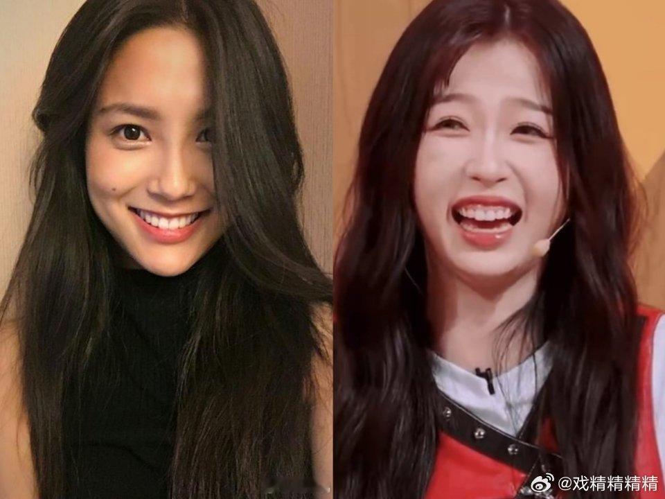 张昊玥抑郁躯体化这么漂亮的姑娘，她的星途应该是光明的，希望身体快点好起来！张昊玥
