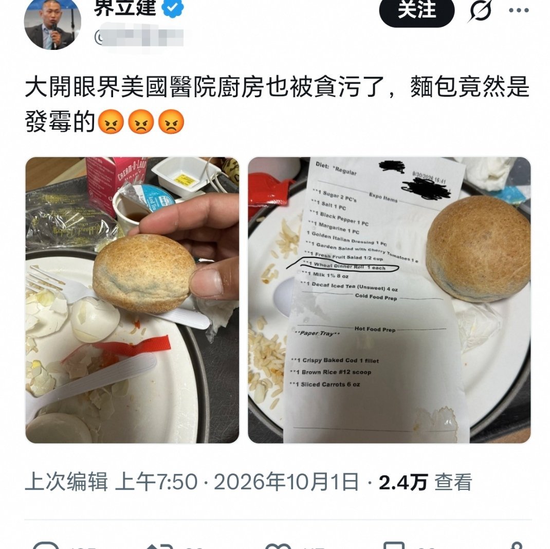 知名润人、甜甜圈好友入住美国医院，结果只能吃着发霉，还没有多少馅的汉堡。[思考]