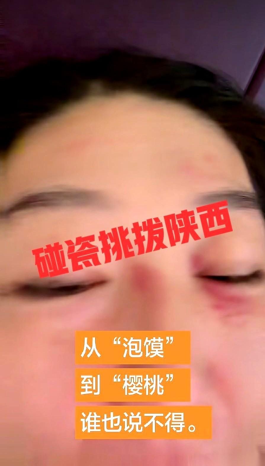 前脚的事儿还没忘干净，网红李某缠后脚又开播了。手机支架就立在桌上，镜头怼着脸，